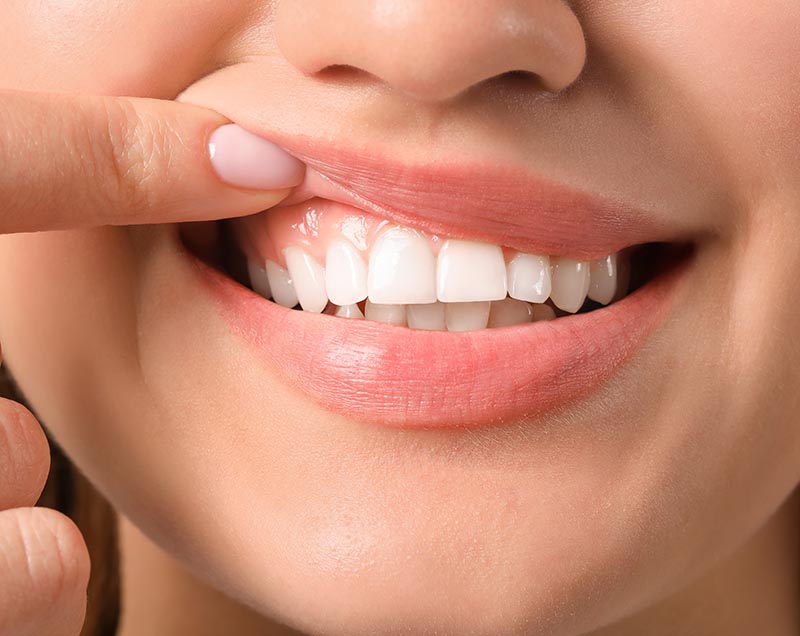 periodontal disease assessment