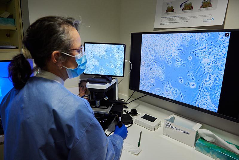 what causes periodontal disease